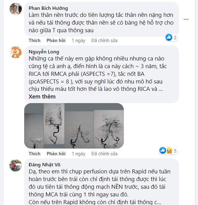 Nhiều ý kiến khác cũng nghiên về tái thông động mạch thân nền trước.