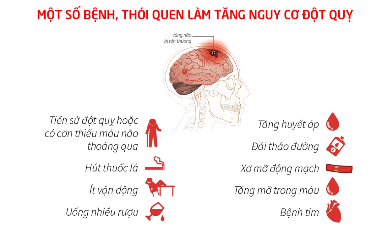 yếu tố nguy cơ đột quỵ