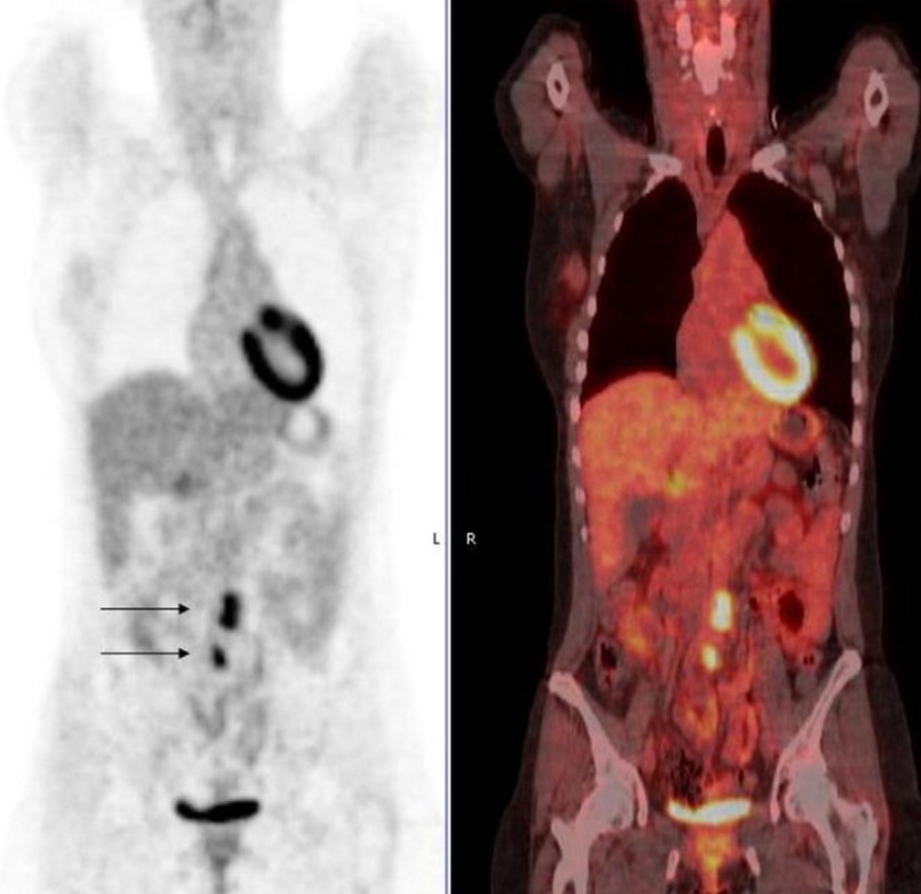 Cách chẩn đoán tình trạng cơ tim ngủ đông?