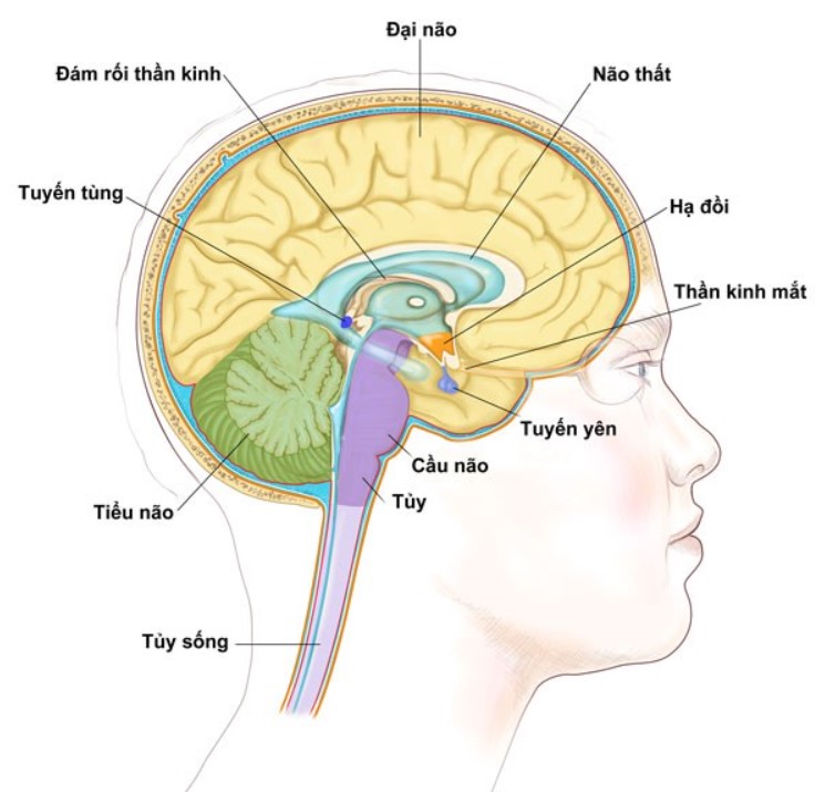 Đột quỵ ảnh hưởng tiểu não có thể dẫn đến chứng mất điều hòa.