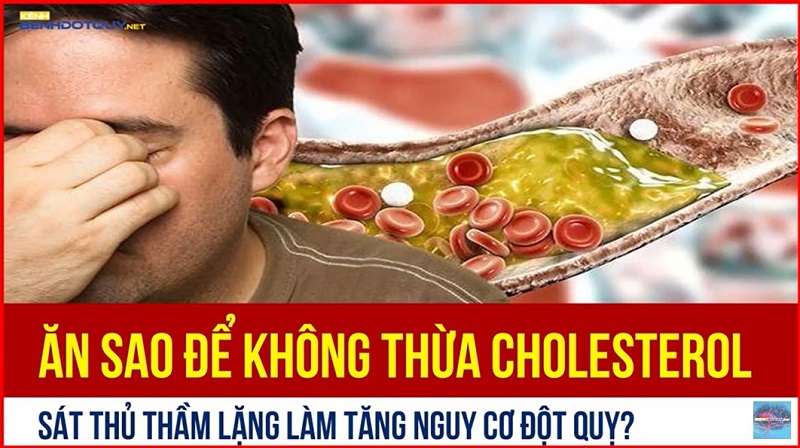 Ăn sao để không thừa Cholesterol – Sát thủ thầm lặng làm tăng nguy cơ đột quỵ