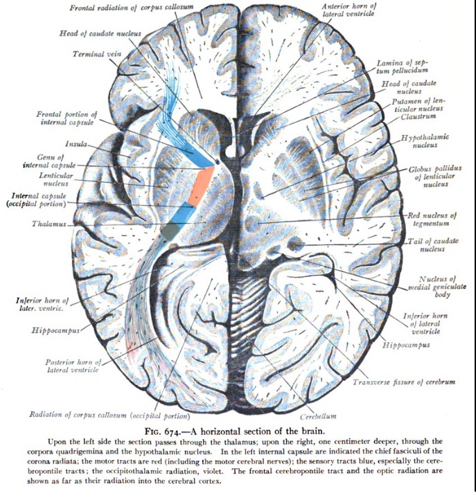Một phần của con đường phóng xạ corona trên não