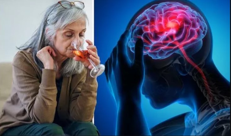 Rượu bia là một yếu tố làm tăng nguy cơ đột quỵ do thiếu máu cục bộ 