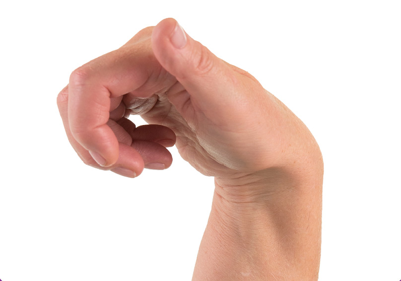 Co cứng sau đột quỵ có thể xuất hiện ngay từ vài ngày đầu hoặc vài tuần, vài tháng thậm chí vài năm sau đột quỵ tùy thuộc thể trạng người bệnh.