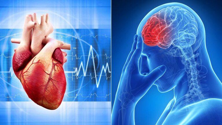 Đối với những người trên 80 tuổi, rung nhĩ là nguyên nhân trực tiếp gây ra 1 trong 4 trường hợp đột quỵ.