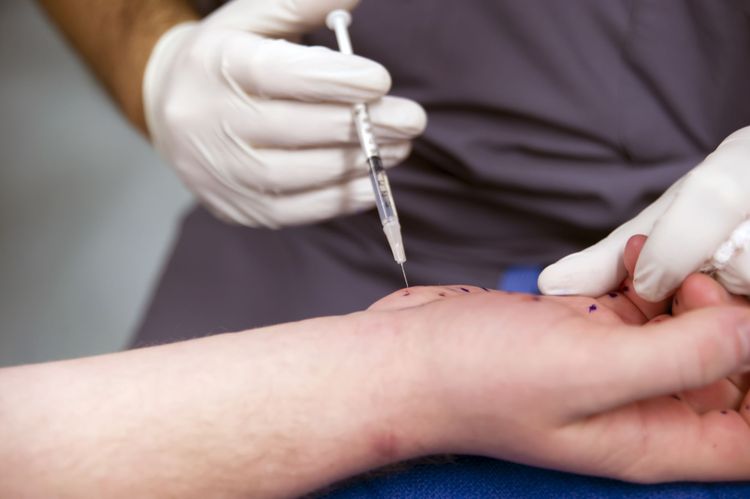 Tiêm botox là liệu pháp có khả năng làm giảm chứng co cứng