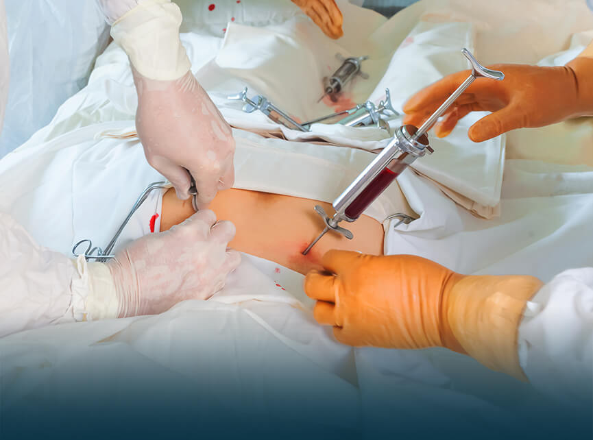 Hầu hết những người cần cấy ghép máu hoặc tủy đều bị ung thư, chẳng hạn như bệnh bạch cầu hoặc ung thư hạch.