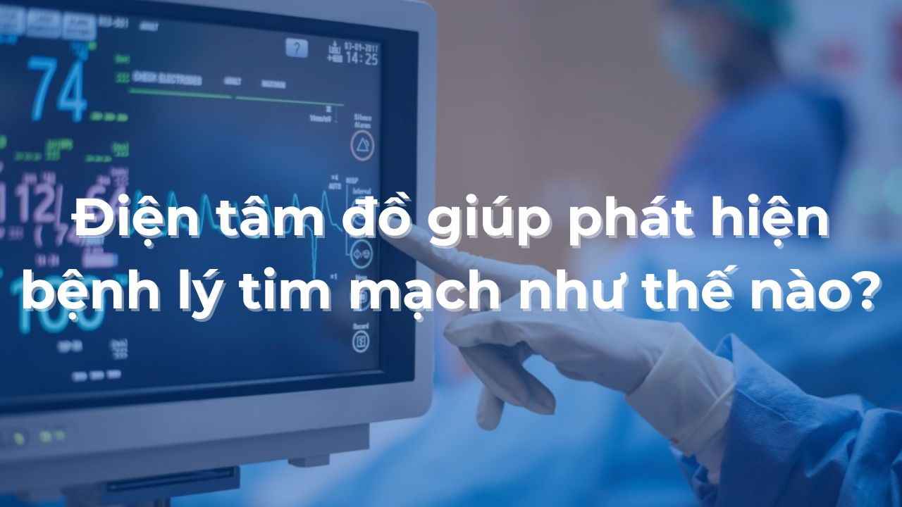 Điện tâm đồ giúp phát hiện bệnh lý tim mạch như thế nào?