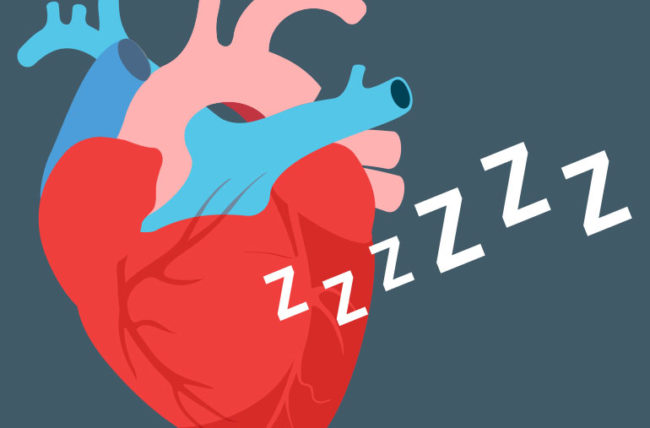 Vùng cơ tim ngủ đông là gì?