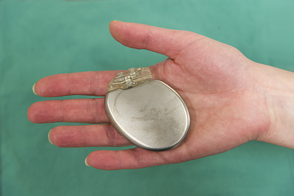 Hầu hết mọi người chỉ cần một cú sốc để khôi phục nhịp tim bình thường, nhưng một số người có thể nhận hai cú sốc trở lên trong 24 giờ.