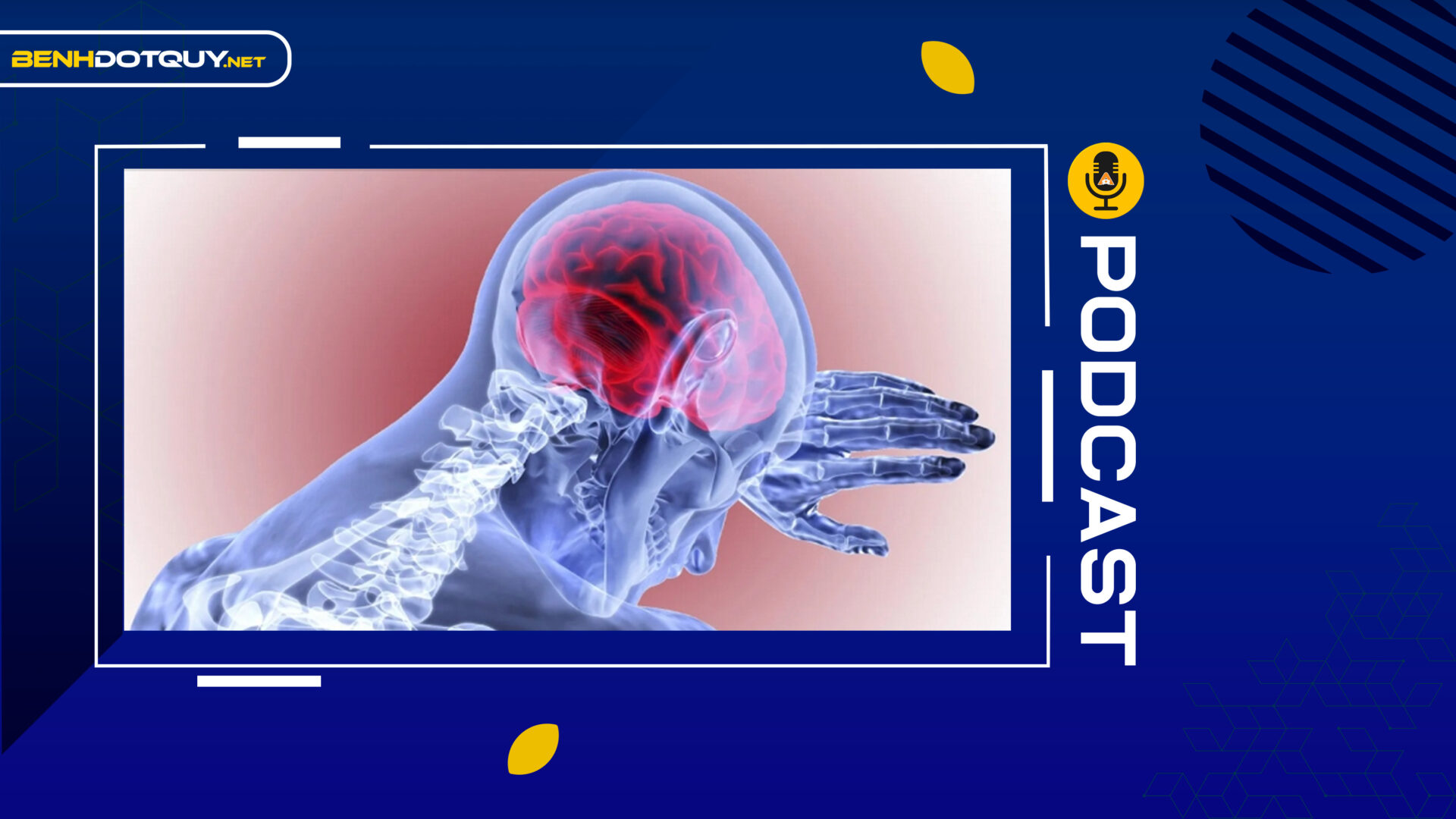 Cô lập và Cô đơn làm tăng nguy cơ đột quỵ thêm 30%