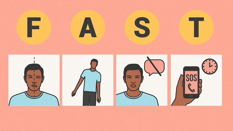 Quy tắc F.A.S.T (nhanh) nhận biết và cấp cứu nhanh người bị đột quỵ 