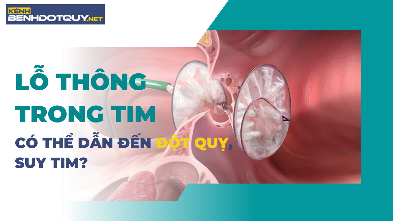 Lỗ thông trong tim có thể dẫn đến đột quỵ, suy tim?
