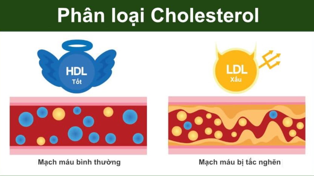 2 loại cholesterol