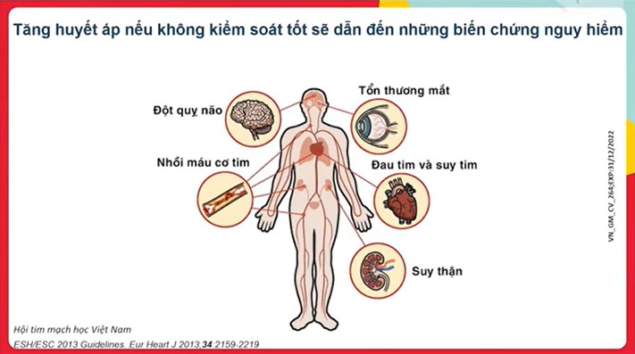 Các biến chứng sẽ xảy ra khi huyết áp không được kiểm soát tốt