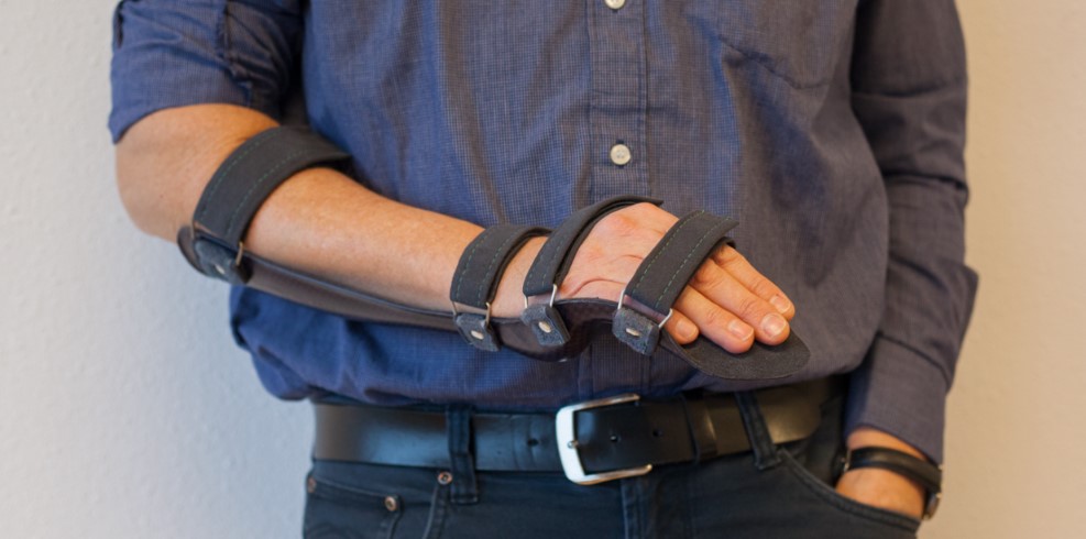 Nẹp cố định bàn tay là loại găng tay cơ bản nhất cho bệnh nhân đột quỵ