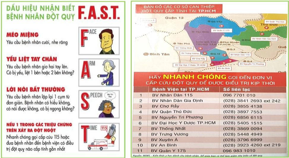 Dấu hiệu nhận biết đột quỵ và danh sách các bệnh viện có khả năng cấp cứu đột quỵ tại TPHCM