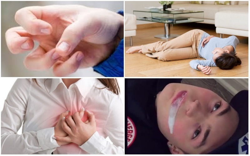 Các cách phân loại động kinh?