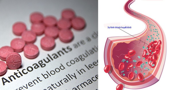 Trước khi bắt đầu sử dụng NOAC nên kiểm tra chức năng thận và gan 