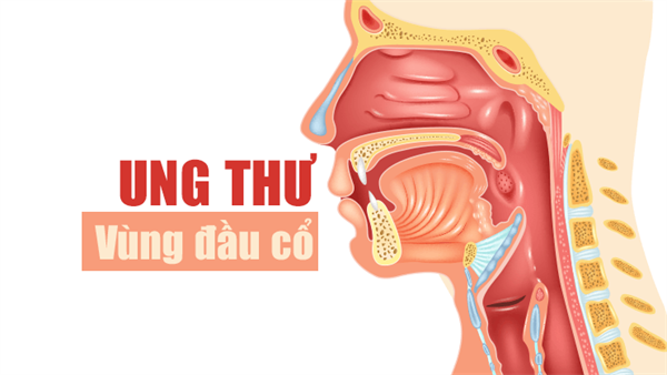 Ung thư đầu và cổ đề cập đến một số loại ung thư ảnh hưởng đến các vùng đầu và cổ của cơ thể.