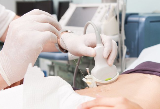 Sinh thiết có thể được sử dụng để chẩn đoán ung thư giai đoạn