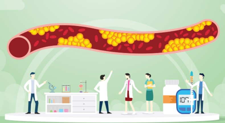 Tăng lipid máu có thể dẫn đến nguy cơ đau tim và đột quỵ