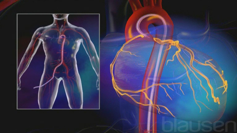 Chụp mạch qua ống thông nên được thực hiện rất thận trọng ở những bệnh nhân có xu hướng chảy máu.