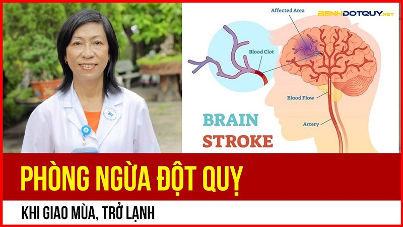 Phòng ngừa đột quỵ khi giao mùa, trở lạnh