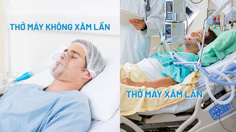 Có nhiều bệnh nhân cần sử dụng máy thở, phổ biến nhất là bệnh nhân có nồng độ oxy máu thấp hoặc bệnh nhân thở khó do phổi nhiễm trùng…