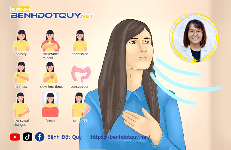 Trường hợp nào người bệnh tuyến giáp có nguy cơ đột quỵ, nhồi máu cơ tim?