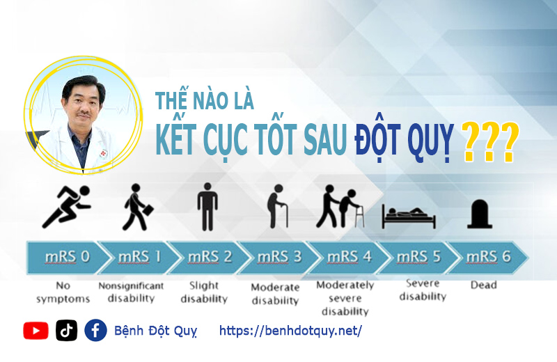 Thế nào là kết cục tốt sau đột quỵ?