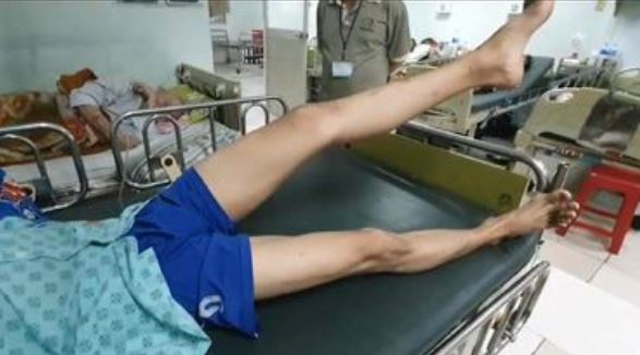 Sức cơ tay và chân của chàng trai đã cải thiện rõ