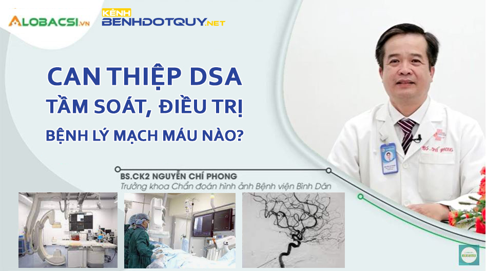 Can thiệp DSA tầm soát được bệnh lý mạch máu gì, ưu điểm ra sao?