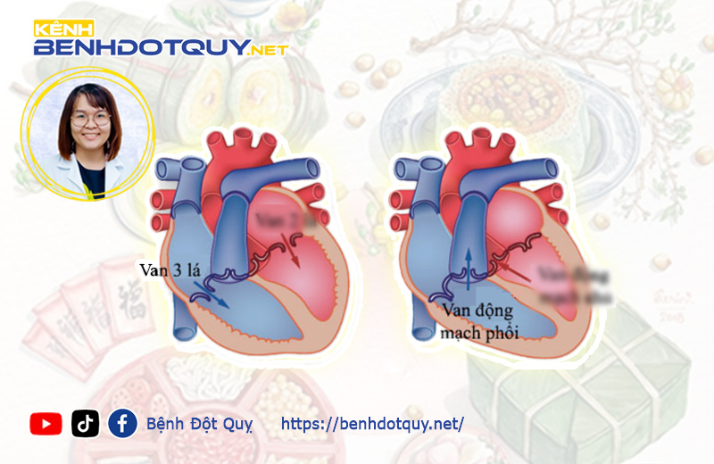 Bệnh nhân hẹp van 3 lá, hẹp van động mạch phổi đi chơi tết sao cho an toàn?