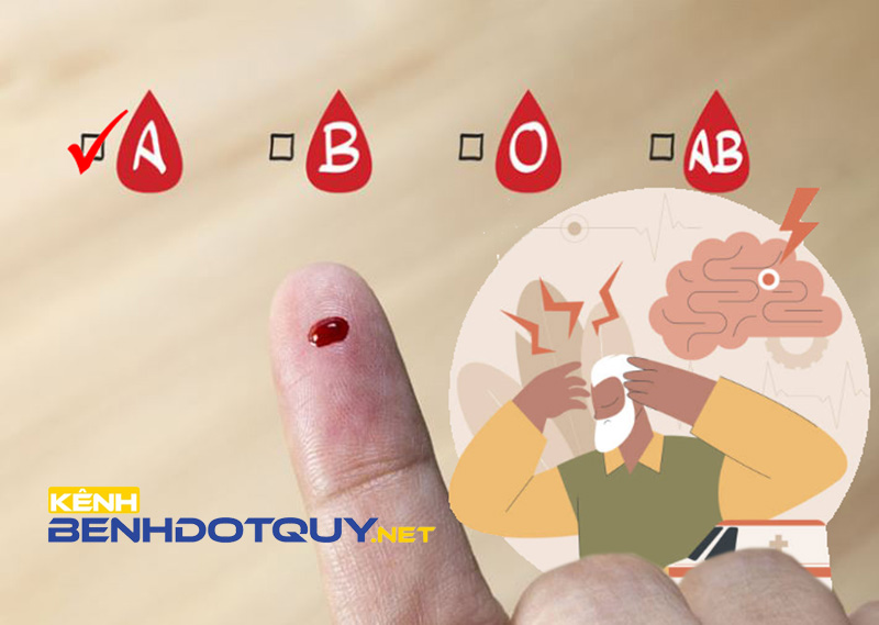 Người thuộc nhóm máu A có nguy cơ mắc đột quỵ cao nhất