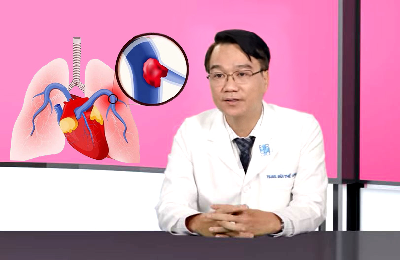 Thuyên tắc phổi có triệu chứng nào dễ phát hiện?