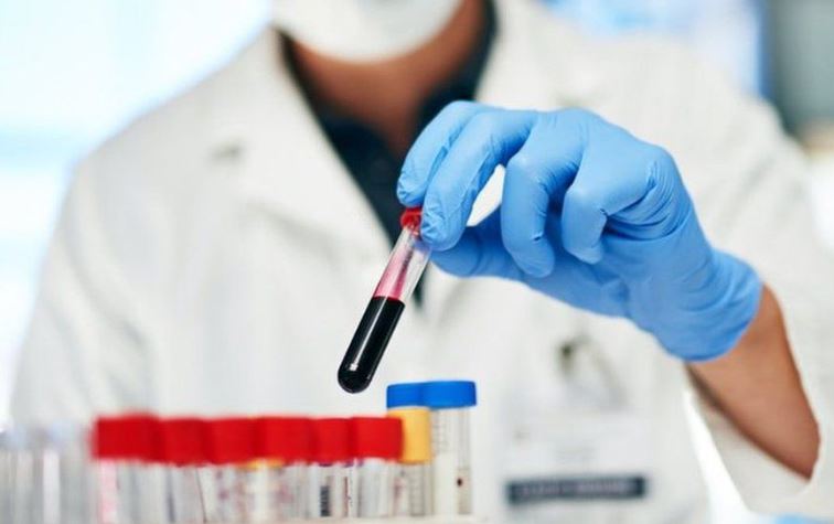 Xét nghiệm máu hứa hẹn có thể phát hiện bệnh Alzheimer