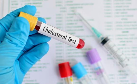 Cholesterol cao, mỡ máu cao gây bệnh gì?