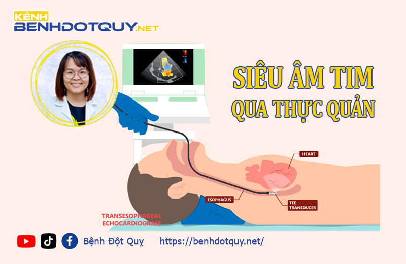Siêu âm tim qua thực quản để làm gì?