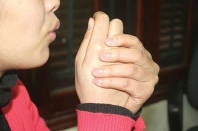 Ngủ chảy nước dãi, lạnh tay chân có phải dấu hiệu cảnh báo đột quỵ?