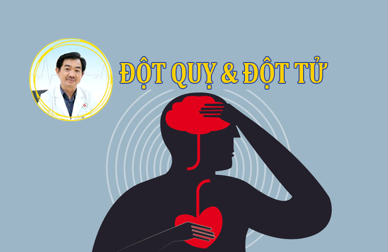 Đột tử gây tử vong nhanh hơn đột quỵ