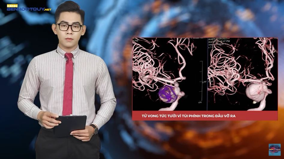 Tử vong tức tưởi vì túi phình trong đầu vỡ ra