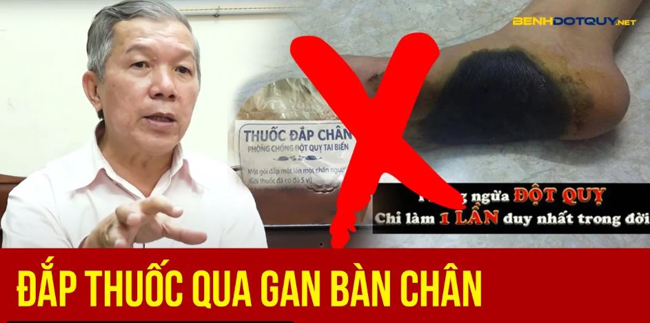 Thực hư: Đắp thuốc qua gan bàn chân một lần ngừa đột quỵ cả đời?