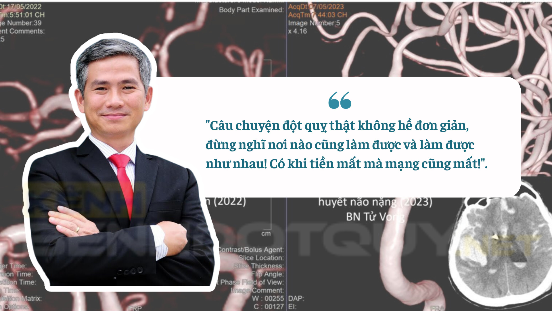 TS.BS Trần Chí Cường: Câu chuyện đột quỵ thật không hề đơn giản, đừng nghĩ nơi nào cũng làm được và làm được như nhau