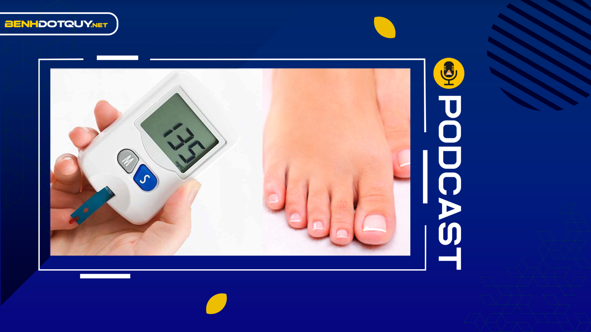 Đôi chân là “máy đo đường huyết”, 5 biểu hiện kỳ lạ này xảy ra thường xuyên hãy coi chừng bệnh tiểu đường