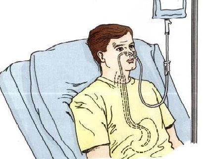 Cuộc sống sau đột quỵ não sẽ như thế nào?