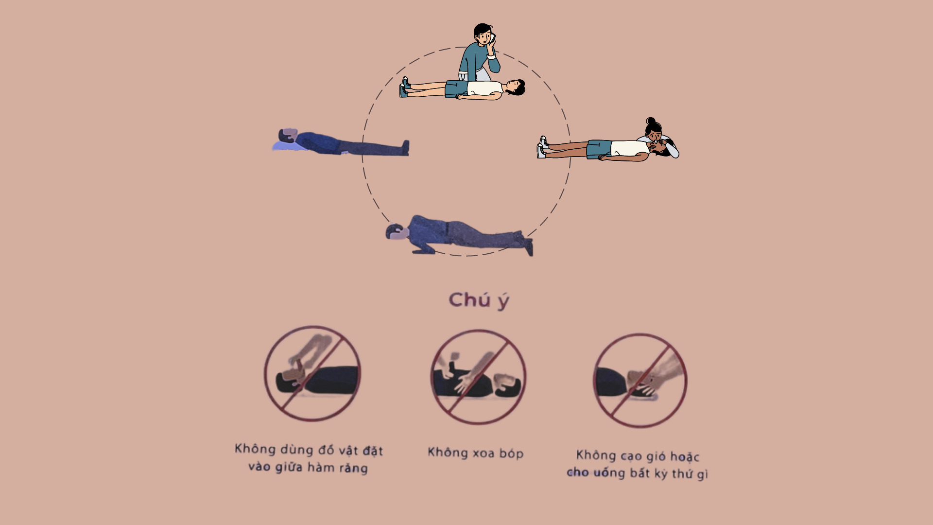 Những nguyên nhân nào dẫn đến đột quỵ não?