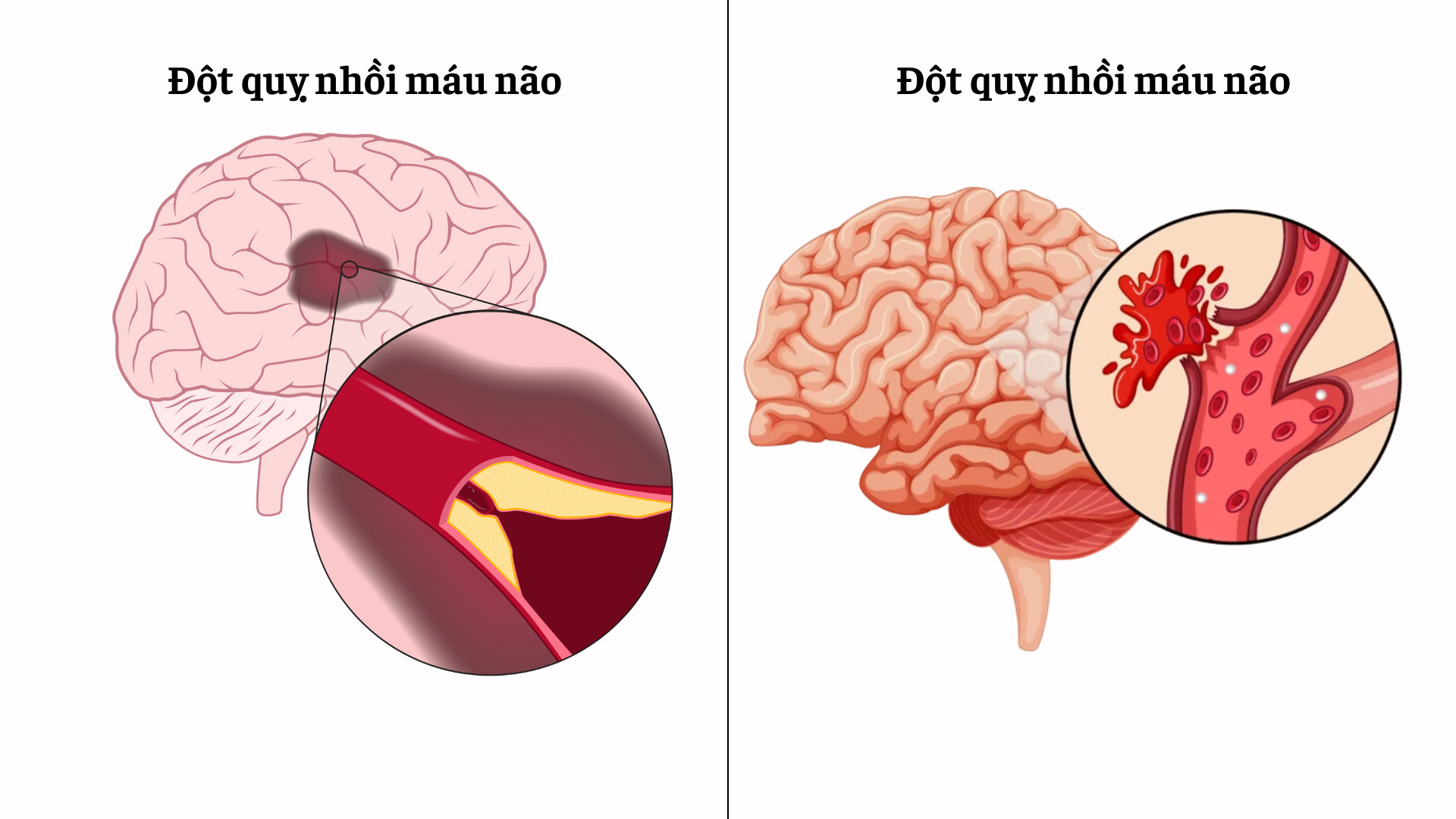 “Căn bệnh tử thần thời 4.0” nguy hiểm như thế nào?