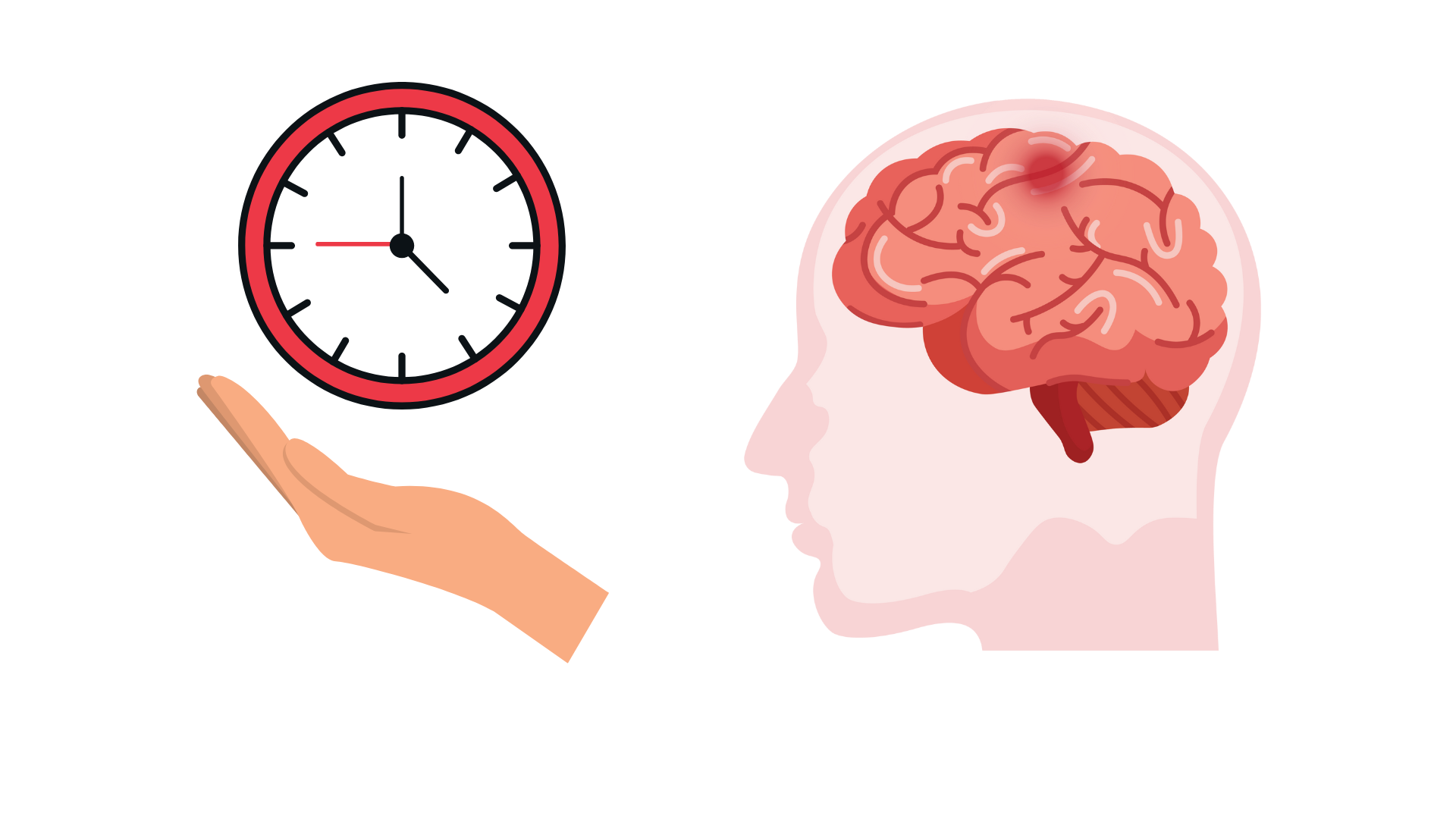 Thời gian vàng trong đột quỵ não hay “thời gian là não”