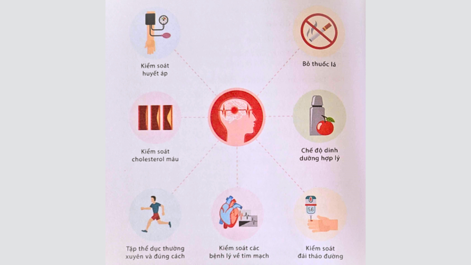 Làm giảm nguy cơ tái phát đột quỵ não bằng cách nào?